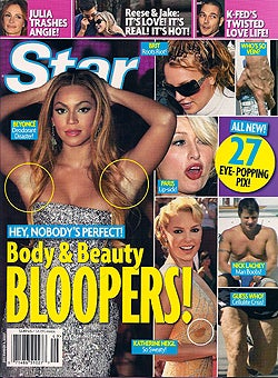 Illustration for article titled This Week In Tabloids: Twisted Childhoods, Plastic Surgery Addictions & Body Bloopers