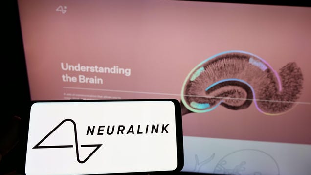 Elon Musk’s Plans to Test Neuralink in Humans Reportedly Squashed by FDA
