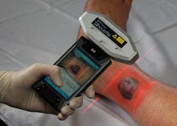 Illustration for article titled Aranz Medical SilhouetteMobile Laser-Equipped PDA Keeps Track of Your Wounds, So You Don't Have To