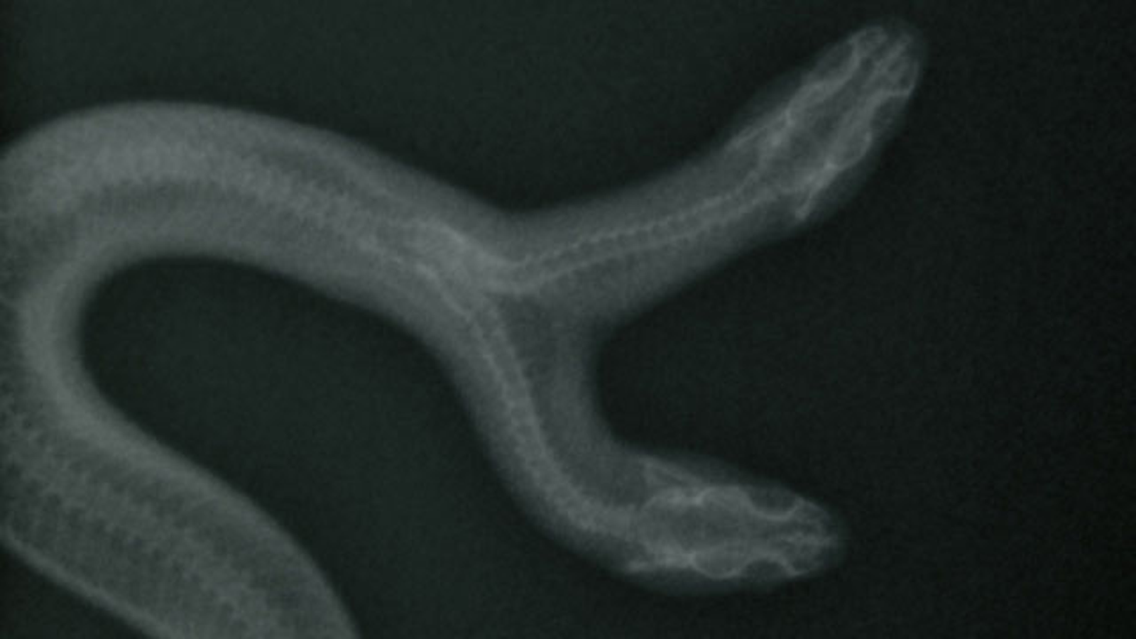 coma x ray