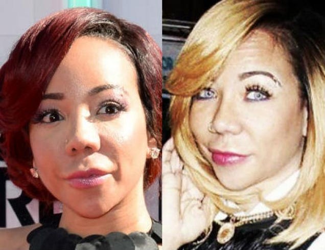 In Defense of Tiny Harris’ New Eye Color