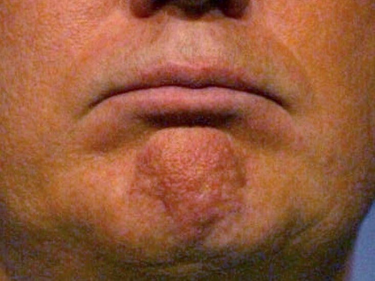 A Visual History of Donald Trump's Mouth