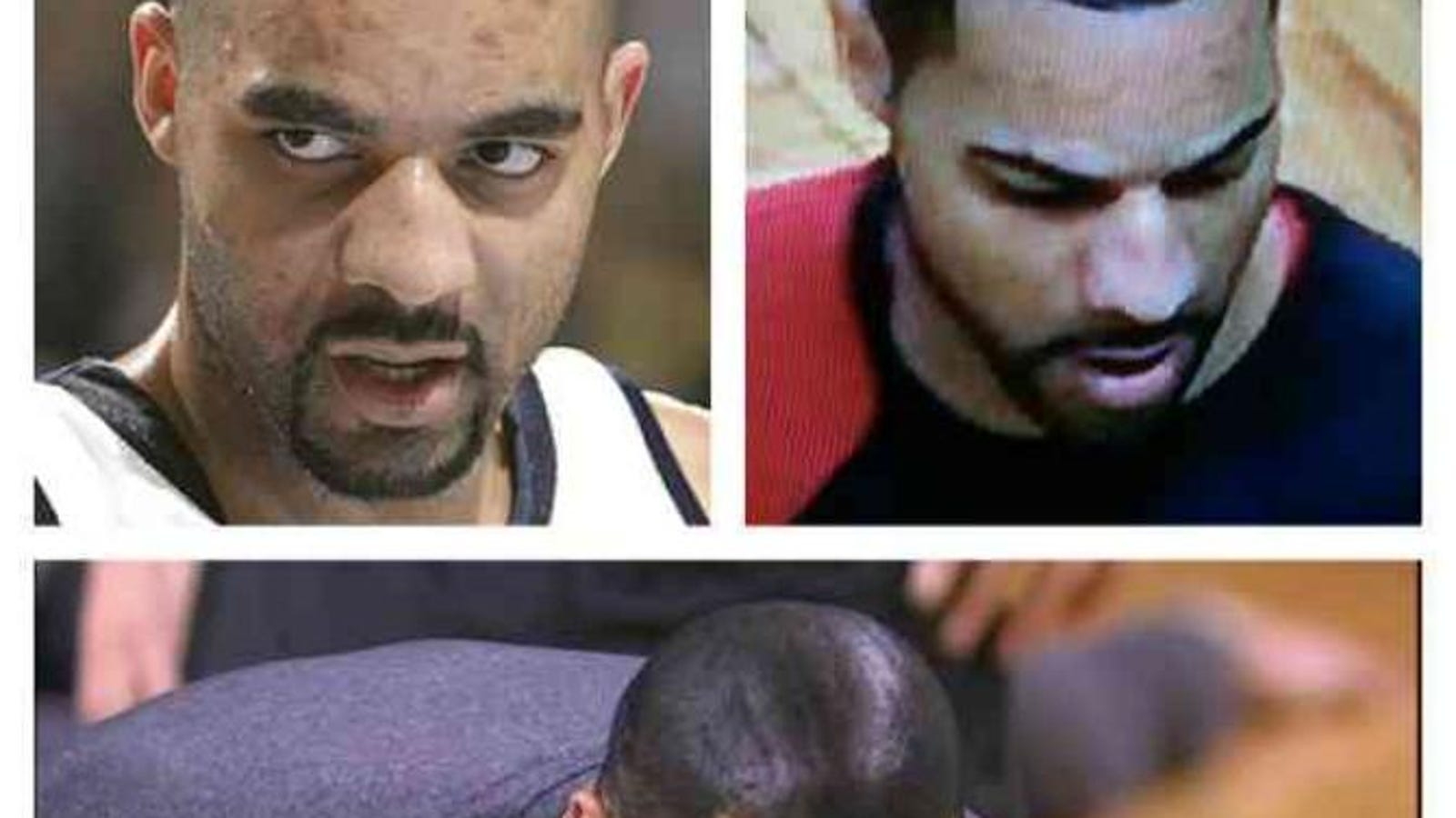 How To Regrow Hair With A Derma Rollerderma Rolling Scalp For Faster Hair Growth Grow Thin Hair