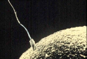 Illustration for article titled Sperm Donor Who's "Fathered" 400 Kids Calls For Better Regulation Of Genetic Material