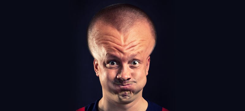 Illustration for article titled Exploding Head Syndrome Is a Real Thing