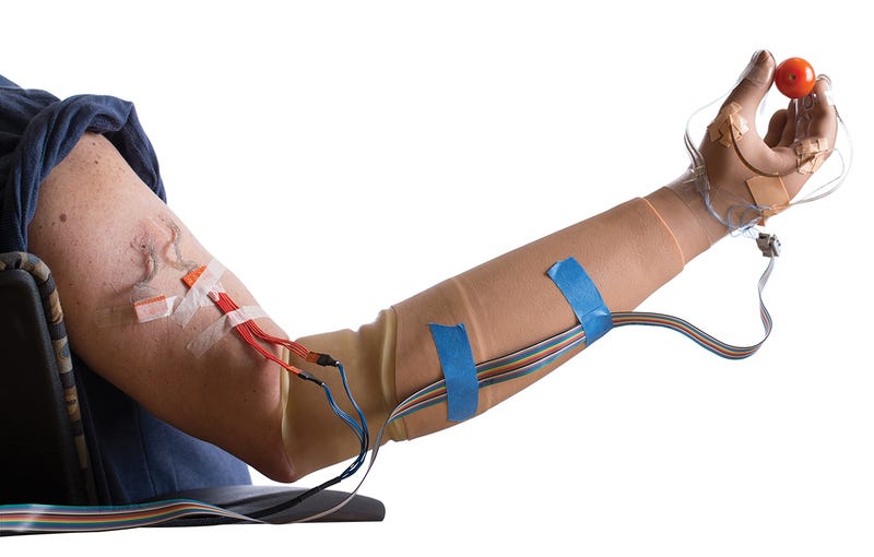Illustration for article titled Esta nueva mano biónica permite recuperar el sentido del tacto