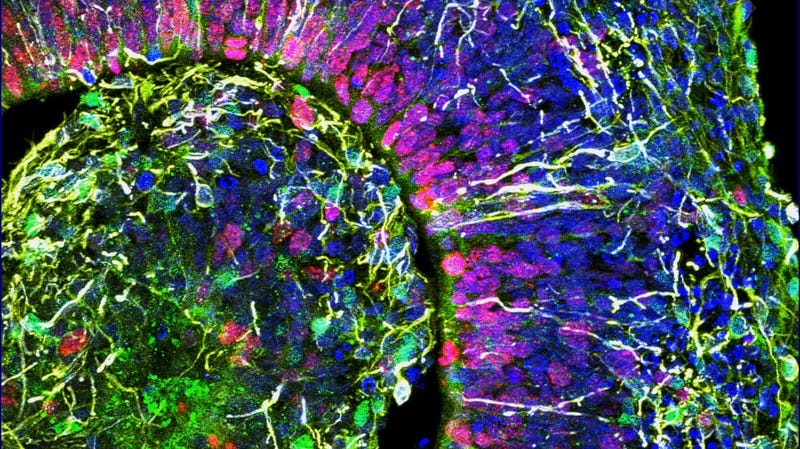 Cross section of a cerebral organoid.