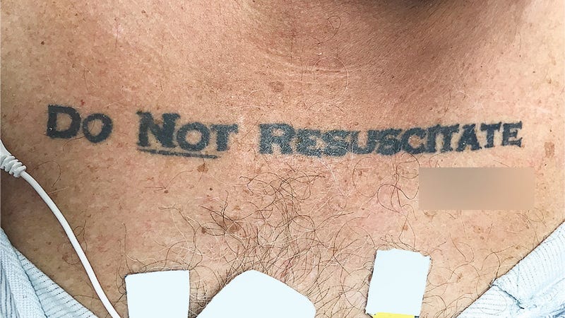 Un hombre llegó inconsciente al hospital con un tatuaje que ponía "no resucitar". Los médicos tuvieron que tomar una decisión Glu0gcrpbprgvf8oibtu