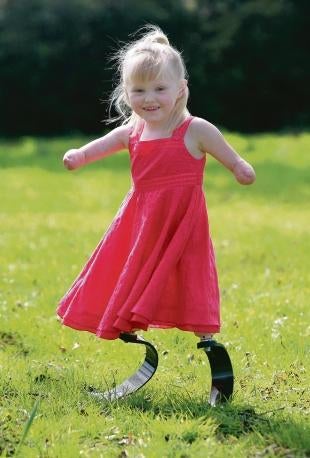 Illustration for article titled 5-Year-Old Amputee Fitted with High Performance Carbon Fiber Legs