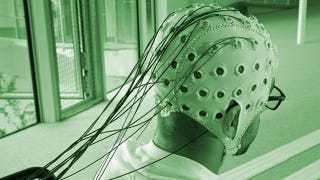 Illustration for article titled Will we ever have cyborg brains?