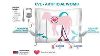 Illustration for article titled Artificial Wombs Are Getting Better and Better