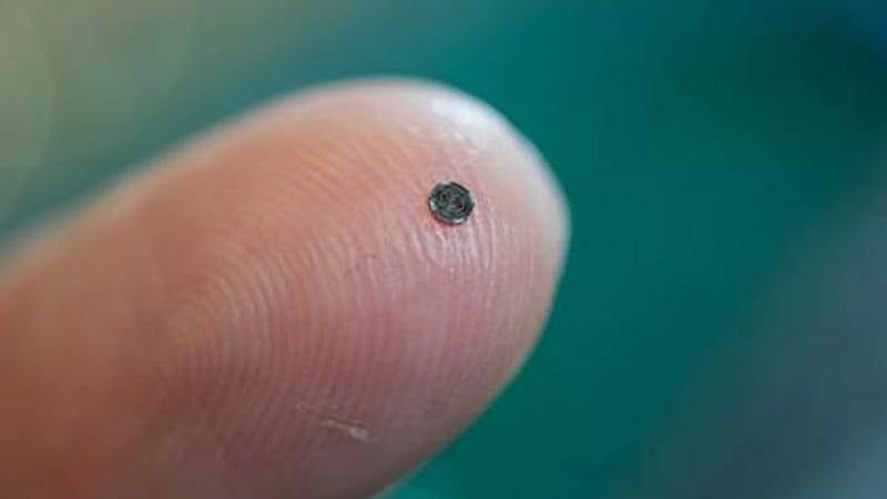 Illustration for article titled This Tiny Chip Could Give Doctors a 3D View From Inside The Heart