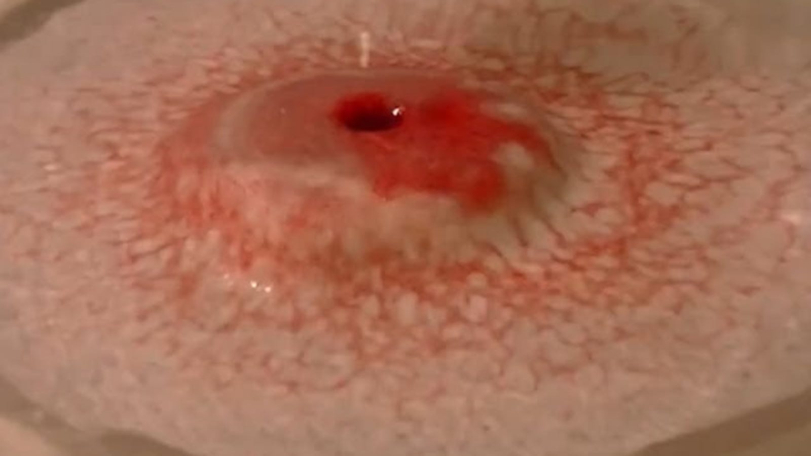 How To Clean Your Ears Without Damaging Them So Your Hearing Stays Category Ear Wax Be Healthy Stay Healthy Massage
