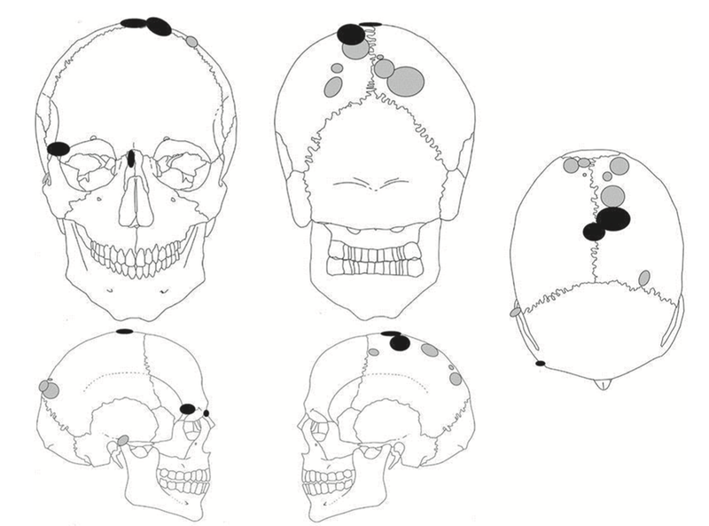 Human Skulls Mounted On Stakes Found At 8 000 Year Old Burial Site In