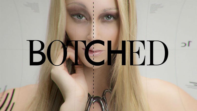 Illustration for article titled Rejoice Fans of Bad Plastic Surgery: Botched Is Coming Back