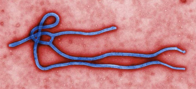 Illustration for article titled Turns Out the Ebola Virus Can Be Sexually Transmitted