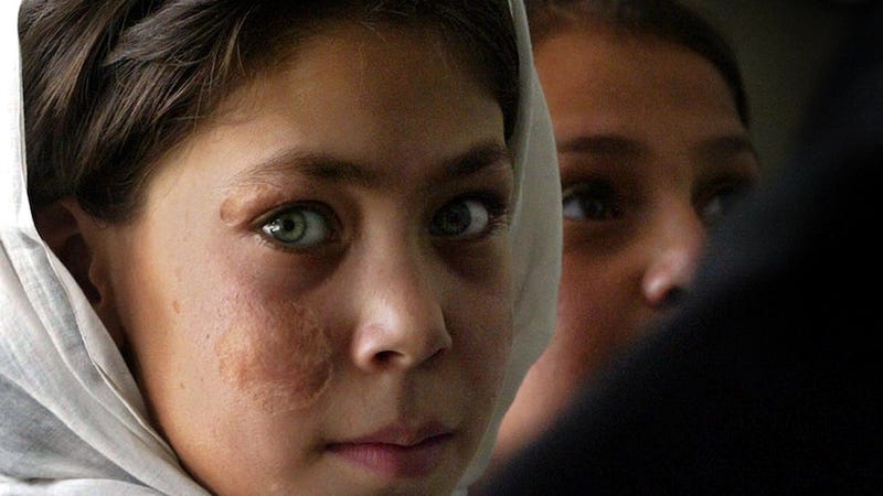 Illustration for article titled 160 Afghan Girls Poisoned For Daring Go to School