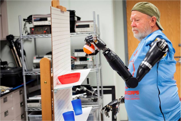Esta increíble prótesis robótica doble se controla con el pensamiento