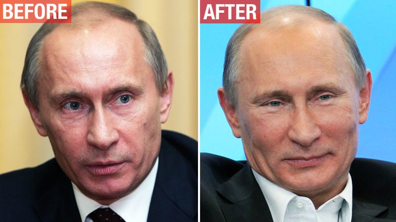 Vladimir Putin Before And After Plastic Surgery - Riset