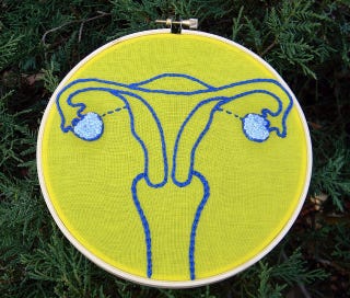 Illustration for article titled Women At Risk For Ovarian Cancer Have New Options, But No Easy Choices
