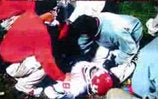 Illustration for article titled Houston, We Have A Compound Fracture