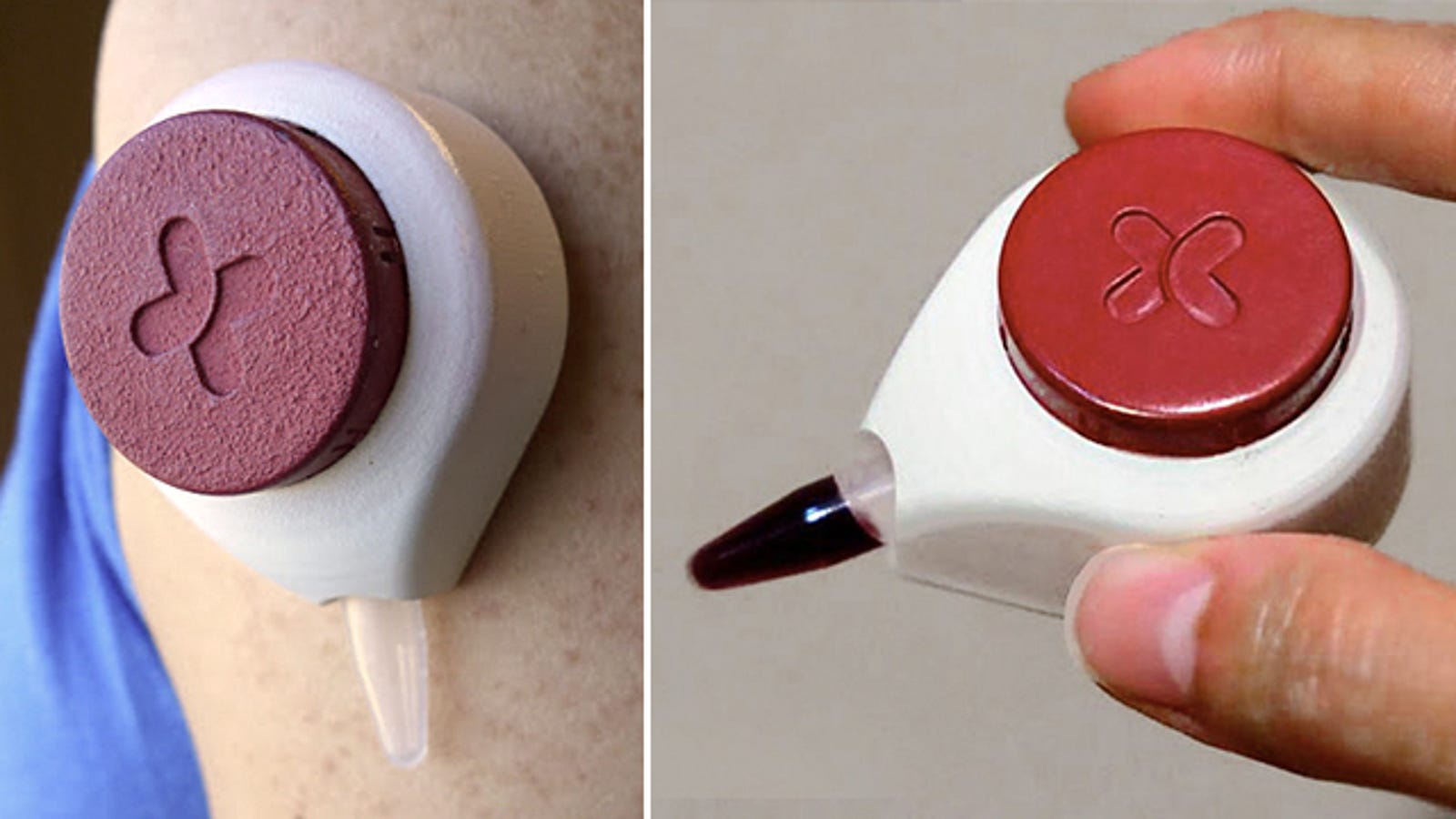 This Vampirelike Suction Device Lets Patients Draw Blood At Home