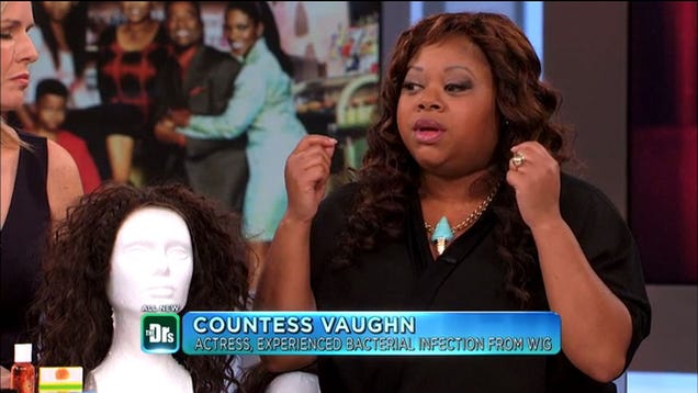 Lacefront Wigs Can Literally Peel Off Your Scalp And Make You Sick