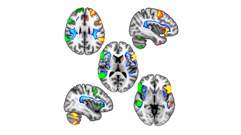 Regions of the brain influenced by accuracy.
