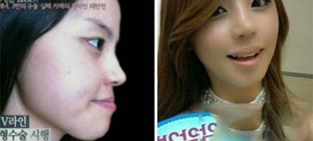 Oh god, Korean plastic surgery will never cease to amaze me