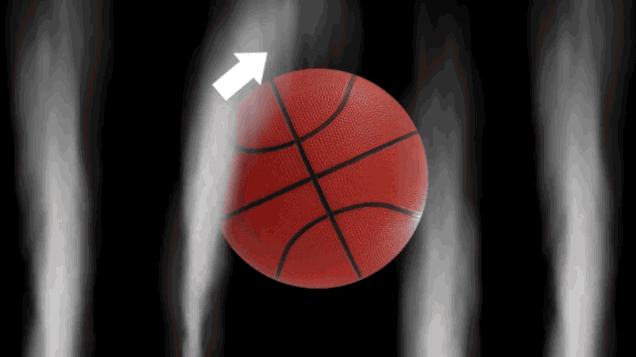 Efecto Magnus sobre una pelota de basquet