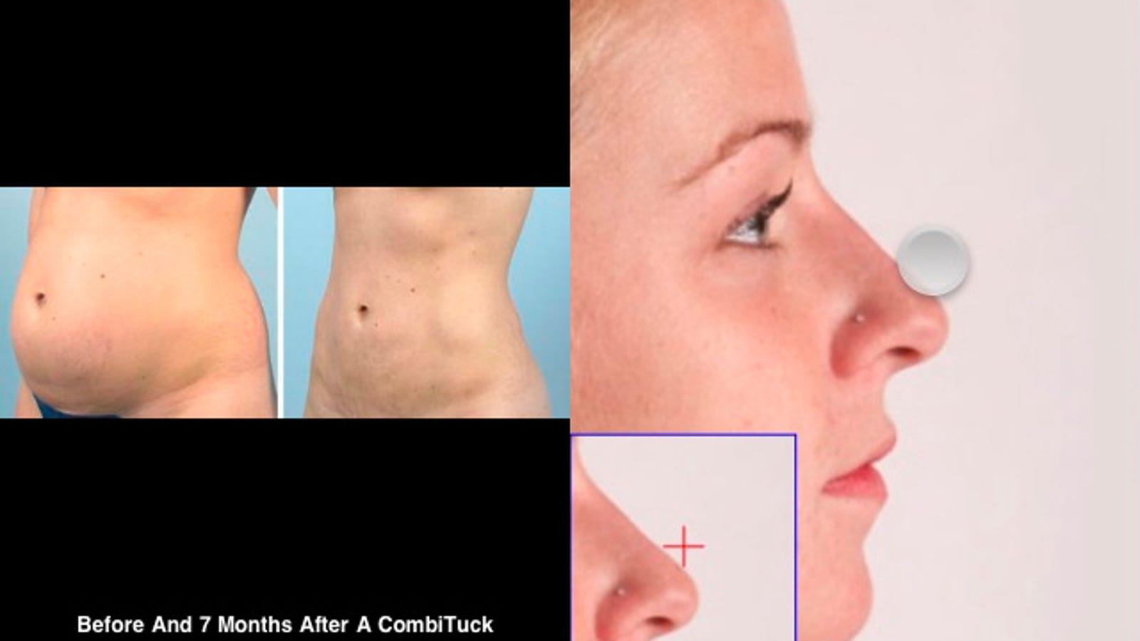 This iPhone Plastic Surgery App Shows You How Ugly You�ll