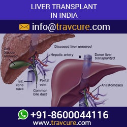 Illustration for article titled Liver Transplant in
India is Matchless and Affordable