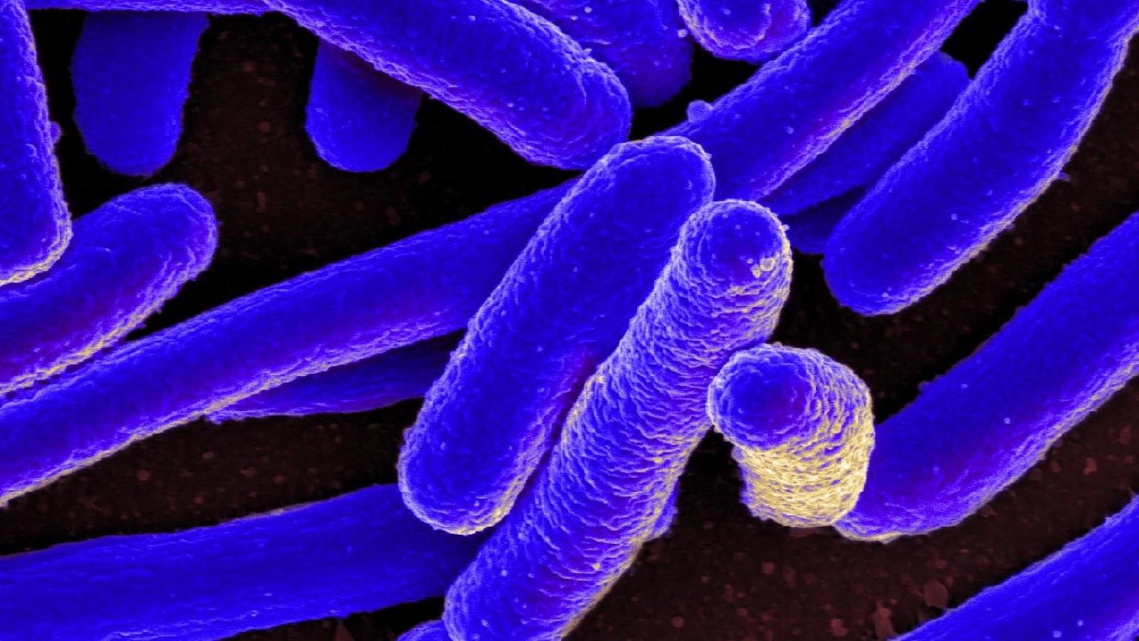 Сероводород бактерии. Nitrosomonas бактерии. Галобактерии археи. Археи микробиология. Археи метаногены.