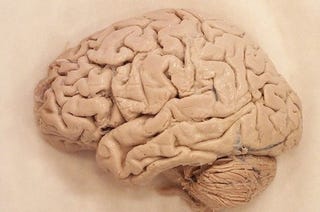 Illustration for article titled Brain-Scanning Lie Detectors May Be Used In Court Soon