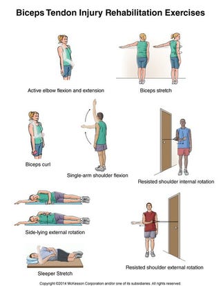 Illustration for article titled Epicondylitis Codo De Tenista Pdf Free