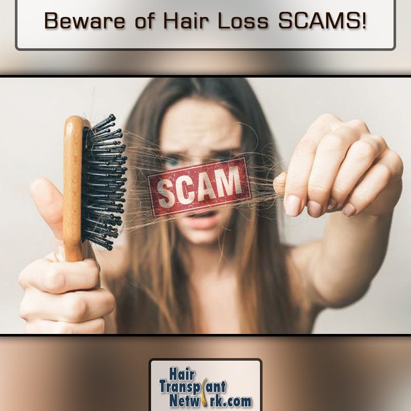 Illustration for article titled Beware of Hair Loss SCAMS!!