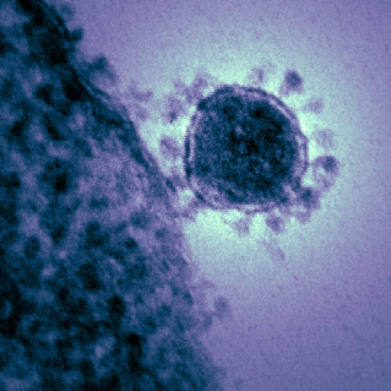 Illustration for article titled The Massive MERS FAQ