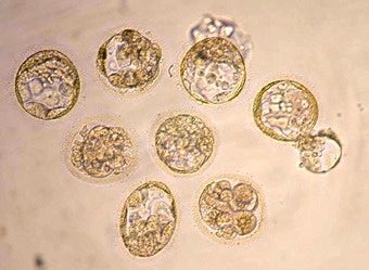 Illustration for article titled Pope Sticks up for Embryos