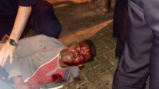 This photo of Martese Johnson shortly before his arrest March 18, 2015, went viral. Johnson claimed Virginia Alcoholic Beverage Control agents beat him bloody. The agents claimed Johnson fell during the arrest. The agents have now been cleared of wrongdoing.Twitter