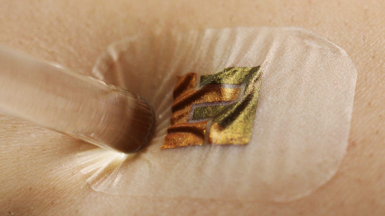 without test blood glucose needle on Needle Sugarâ€”No Blood Stick Biosensor This Monitors