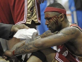 Illustration for article titled LeBron Watch, Day 2: No, Seriously, Mo Williams Runs A Pit Bull Business