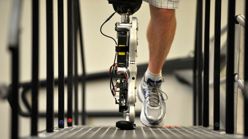 Man with Bionic Leg