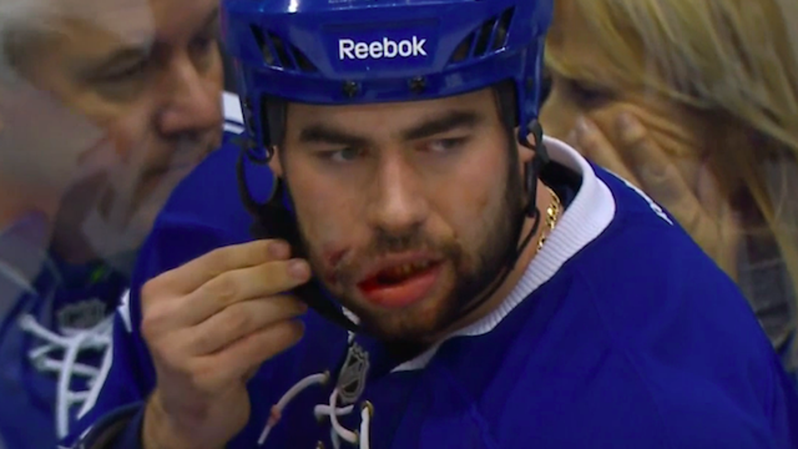 Roman Polak Messed Up By Slapshot To The Face