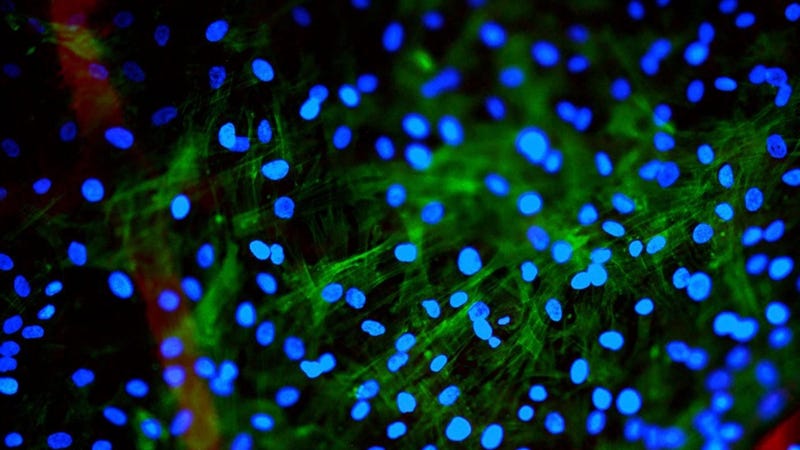Human mesenchymal stem cells (Image: Rose Spear/Flickr)