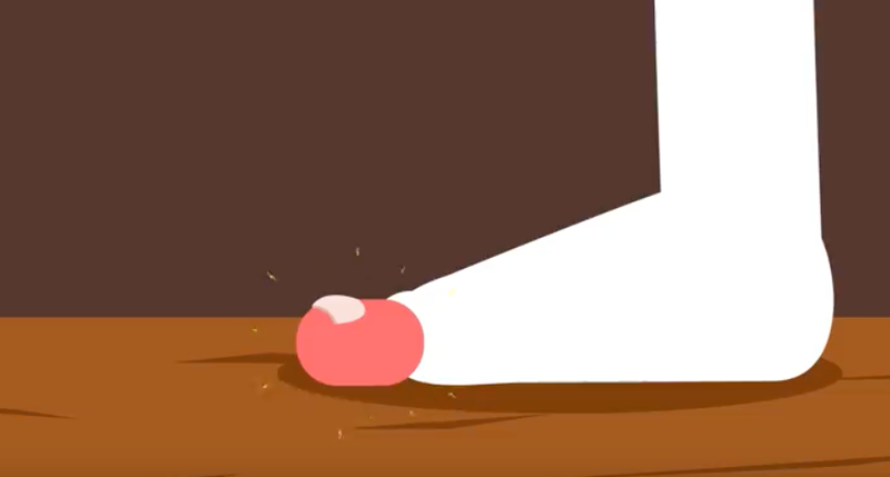 Illustration for article titled Por qué duele tanto cuando te das un golpe en el dedo del pie