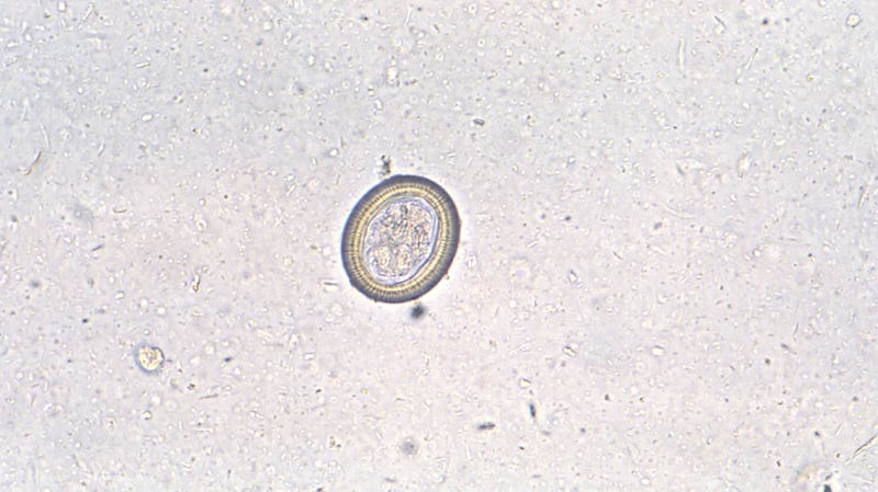 Above, the egg from a member of the Taenia family of tapeworms.