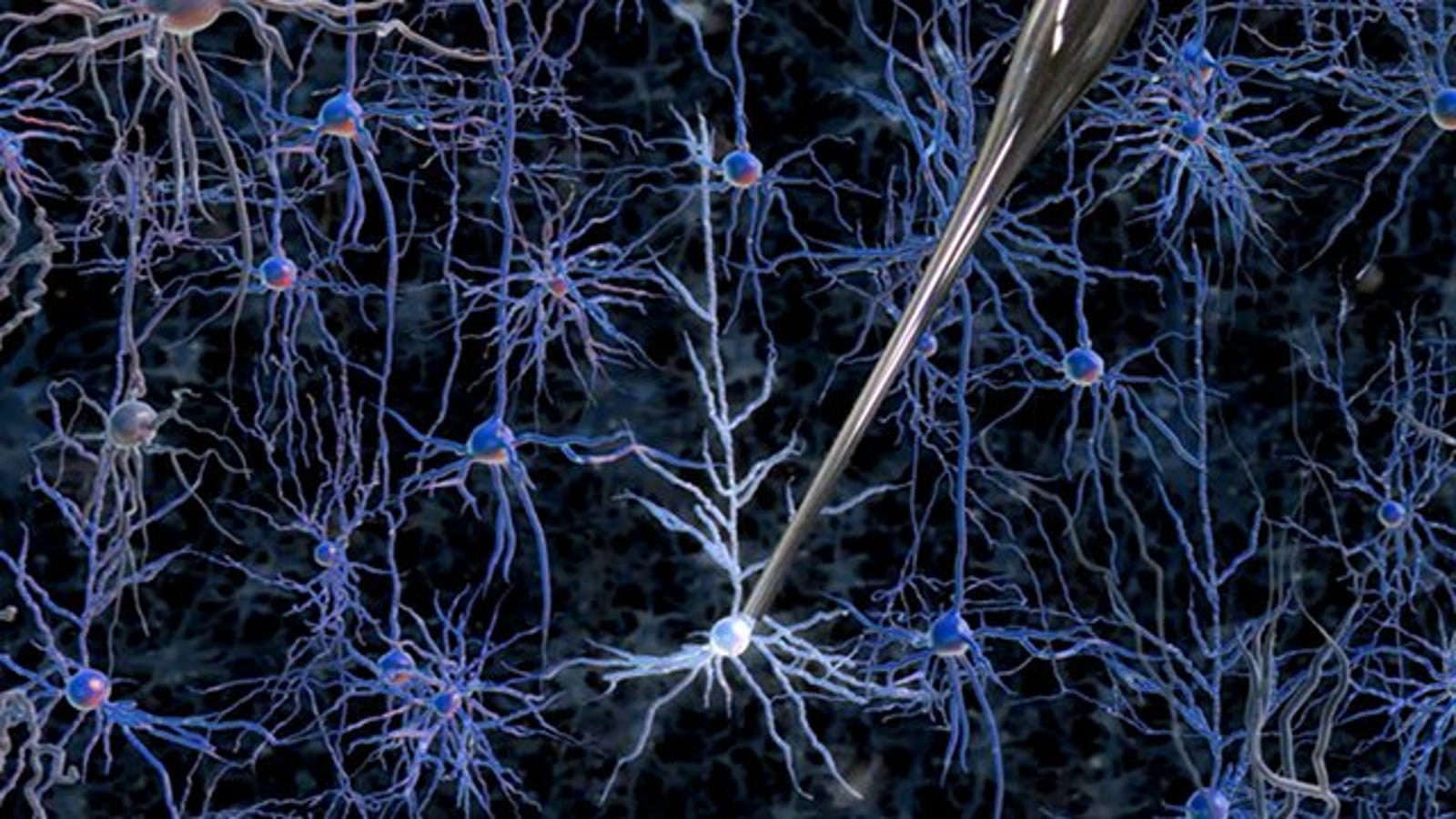 Как называются клетки головного мозга. Нейрон микрофотография. Нейроны мозга под микроскопом. Клетки мозга под микроскопом. Нейроны в микроскопе.