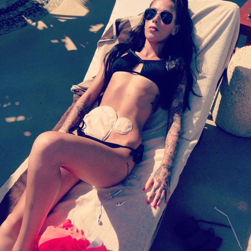 Illustration for article titled Woman Living With Crohn's and Colostomy Bag Pursues Modeling Career