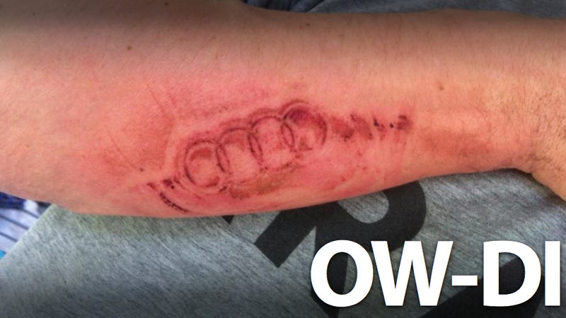 An Exploding Airbag Branded An Audi Logo On This Man S Arm