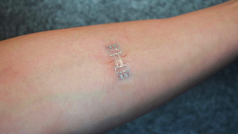 Bandage-Like Gadget Could Make Stitches and Staples a ...